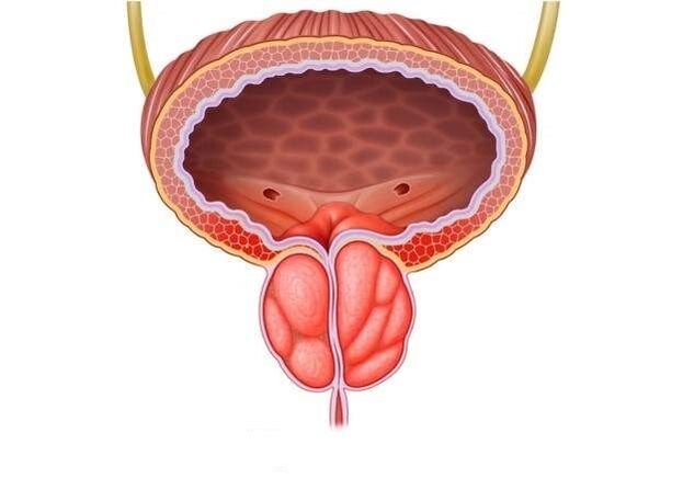 zapalenie prostaty u mężczyzn