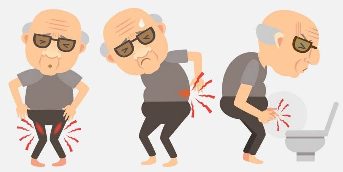 objawy zapalenia prostaty